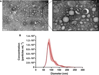 Extracellular Vesicles Produced by the Probiotic Propionibacterium freudenreichii CIRM-BIA 129 Mitigate Inflammation by Modulating the NF-κB Pathway